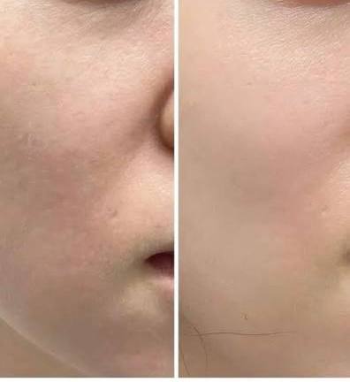 Texture & pore refinement